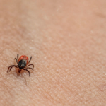 Your Guide to Tick Safety